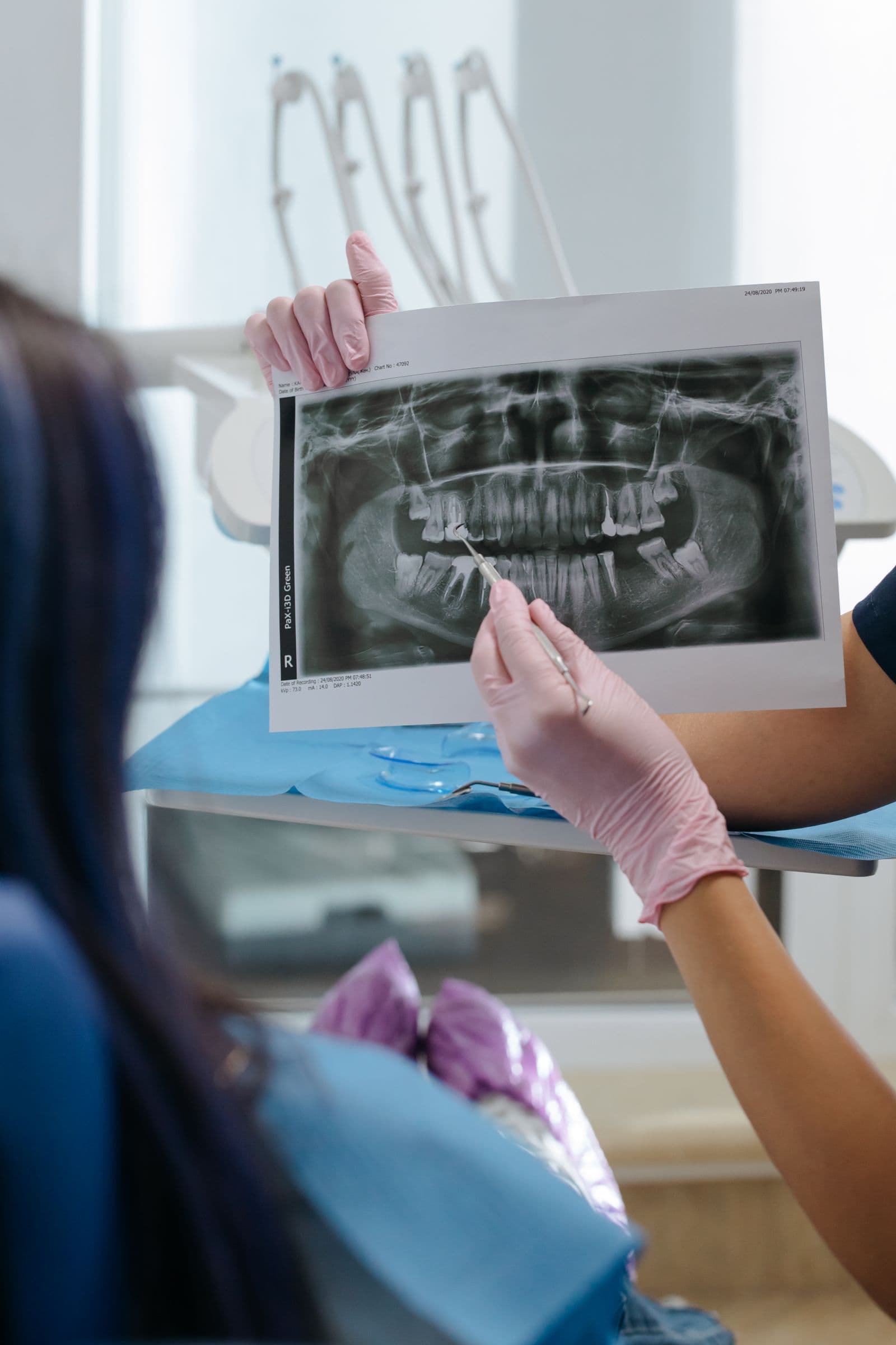 radiografia panorâmica